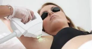 Épilation laser visage et zones sensibles à Creully sur Seulles